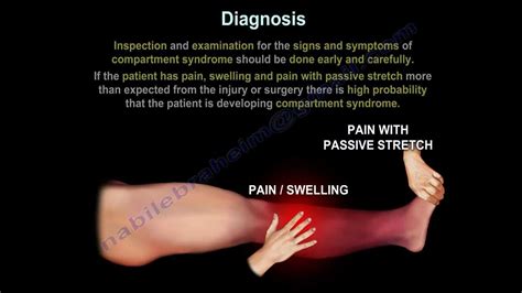 compartment syndrome compression test|early signs of compartment syndrome.